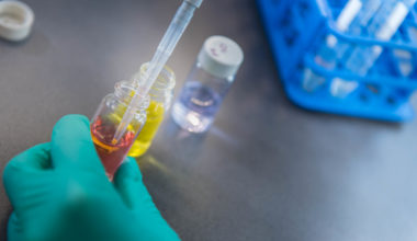 Closeup of pipetting in the lab at the Djavad Mowafaghian Centre for Brain Health