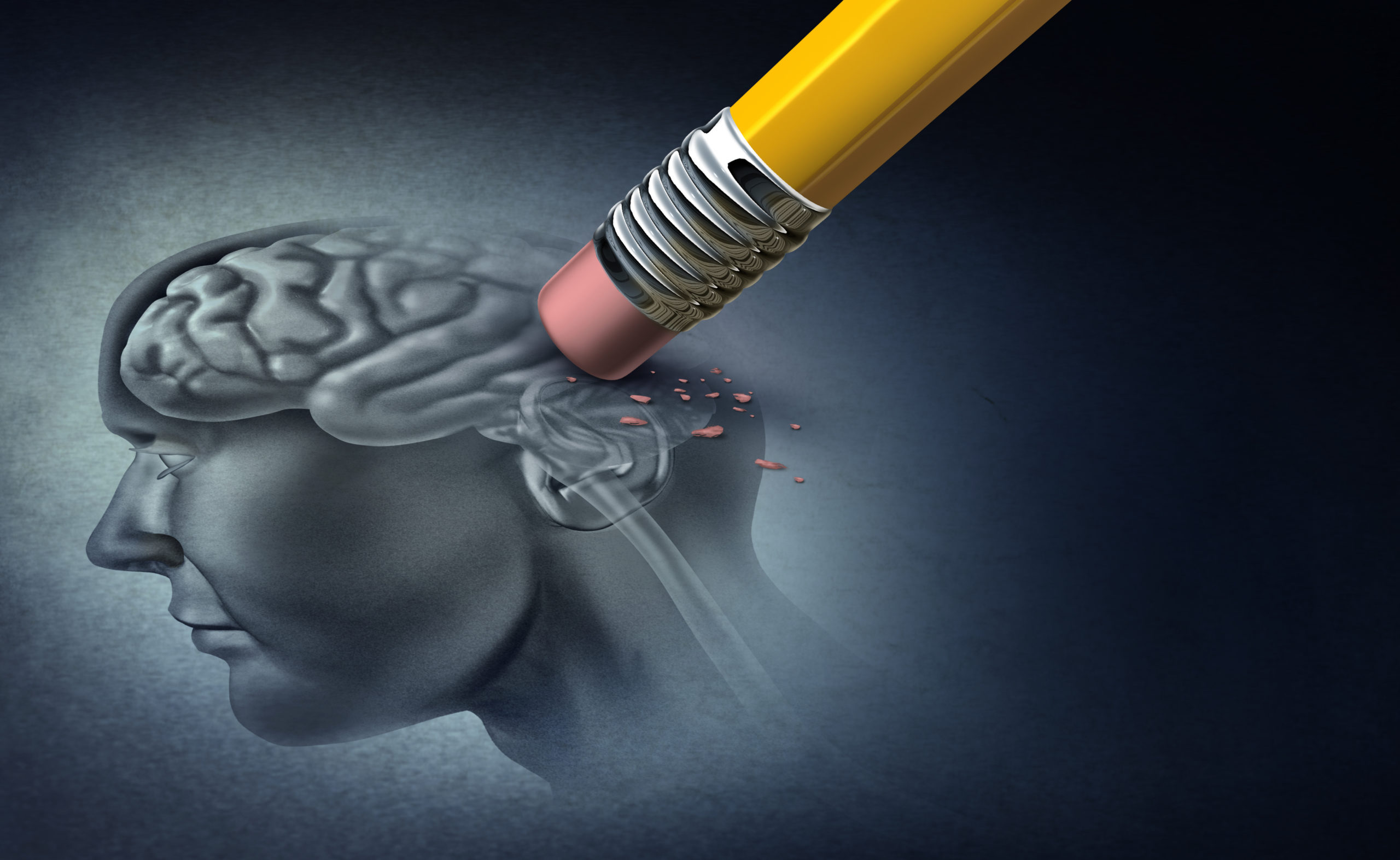 Concept of memory loss and dementia disease and losing brain function memories as an alzheimers health symbol of neurology and mental problems with 3D illustration elements.